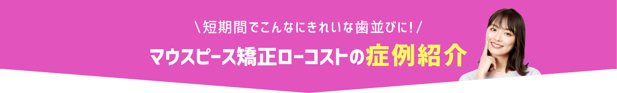 マウスピース矯正ローコストの症例紹介