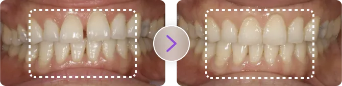 症例写真