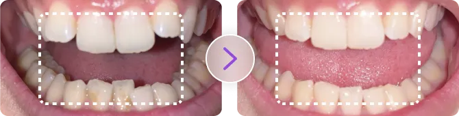 症例写真