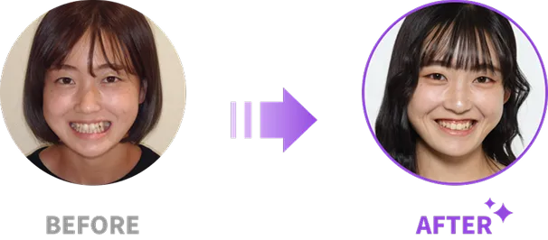 Before After