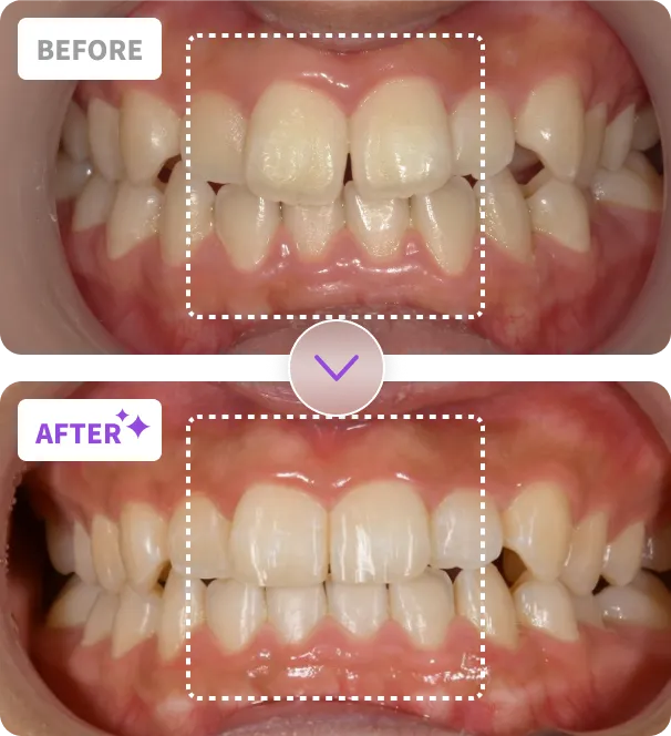 Before After